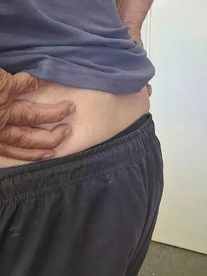 bum 