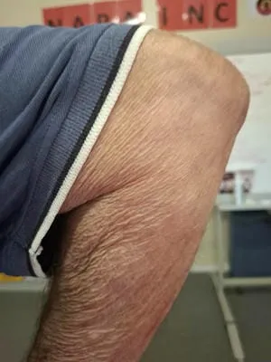 knee 