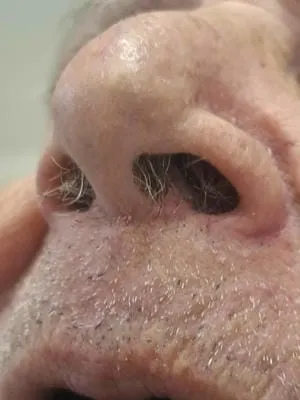 nostril 