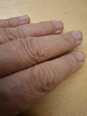 wrinkled2 