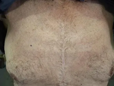 man s chest