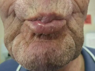 mouth 
