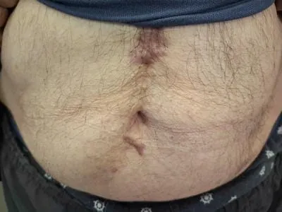stomach 