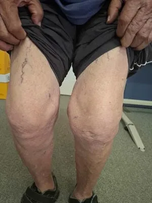 thigh 
